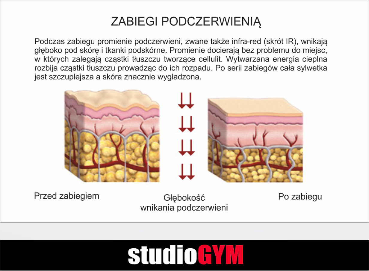 StudioGYM Roller Activ| Szczecin Police | Fit Studio Figura Smukła Sylwetka Cellulit | Fitness klub Vacu Bieżnia Podciśnienie Podczerwień | Siłownia Solarium Sauna Odchudzanie Opalanie Spa Wellness